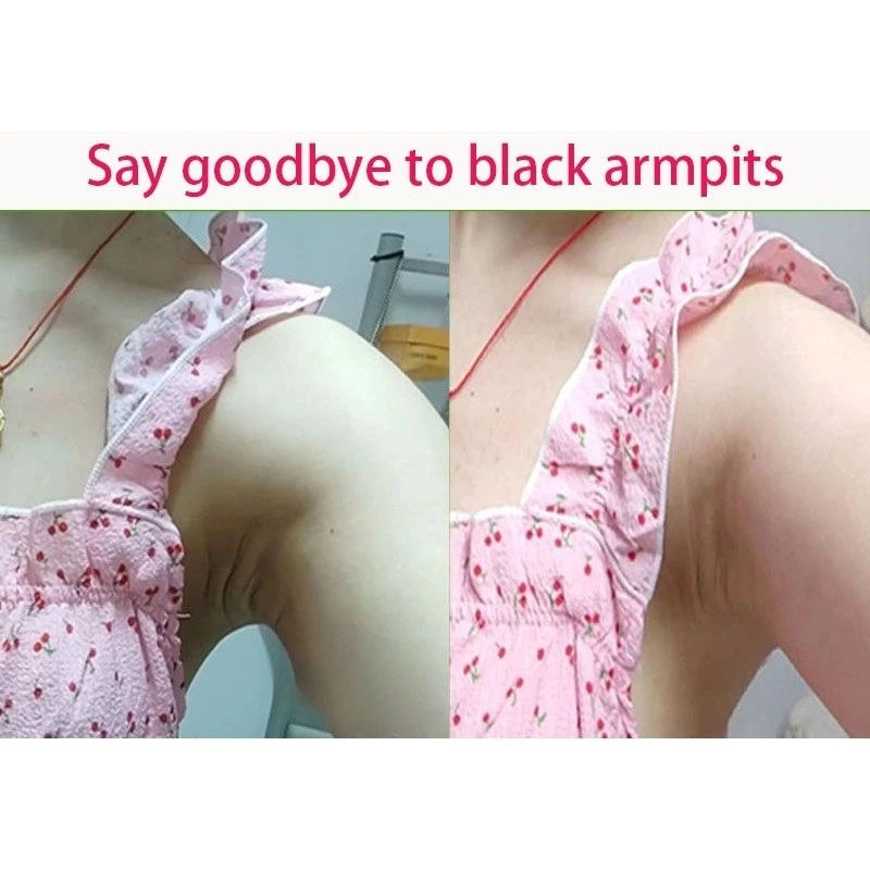 Clareamento Da Virilha E Axilas/Pele Do Grão /creme clareador de virilha e axilas/creme clareador de pele/creme para clarear axila e virilha/creme clareador corporal - Imagem 3