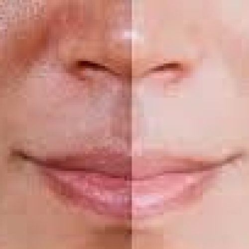 Novas Técnicas de Clareamento: Beleza e Tecnologia a Favor do Sorriso